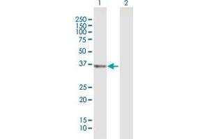 Western Blot analysis of UCHL5 expression in transfected 293T cell line by UCHL5 MaxPab polyclonal antibody. (UCHL5 Antikörper  (AA 1-326))