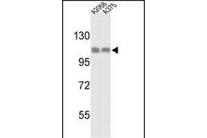 Western blot analysis of HSPH1 Antibody (C-term) (ABIN389381 and ABIN2839476) in  and  cell line lysates (35 μg/lane). (HSPH1 Antikörper  (C-Term))