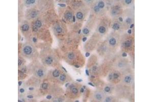 IHC-P analysis of Mouse Tissue, with DAB staining. (MYH1 Antikörper  (AA 1585-1642))