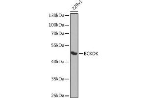 Western blot analysis of extracts of 22Rv1 cells, using BCKDK antibody (ABIN6127484, ABIN6137492, ABIN6137493 and ABIN6224210) at 1:1000 dilution. (BCKDK Antikörper  (AA 153-412))
