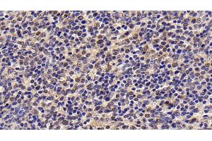 Immunohistochemistry (IHC) image for anti-Baculoviral IAP Repeat-Containing 5 (BIRC5) (AA 1-142) antibody (ABIN7426451)
