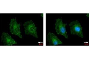 ICC/IF Image TSPAN3 antibody detects TSPAN3 protein at cytoplasm by immunofluorescent analysis. (Tetraspanin 3 Antikörper)
