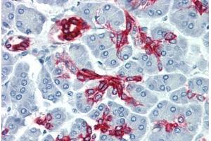 Human Pancreas (formalin-fixed, paraffin-embedded) stained with KRT19 antibody ABIN396943 at 10 ug/ml followed by biotinylated anti-mouse IgG secondary antibody ABIN481714, alkaline phosphatase-streptavidin and chromogen. (Cytokeratin 19 Antikörper)