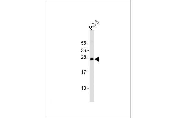 DDIT3 Antikörper  (C-Term)