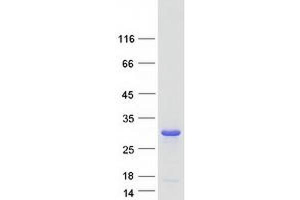VPS28 Protein (Transcript Variant 1) (Myc-DYKDDDDK Tag)