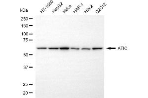 Western blotting analysis using ATIC antibody (ABIN7797425). (ATIC Antikörper)