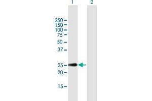 Western Blotting (WB) image for anti-C-Type Lectin Domain Family 2, Member D (CLEC2D) (AA 1-191) antibody (ABIN949235)