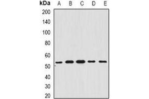 Western blot analysis of BAR expression in A549 (A), SHSY5Y (B), mouse brain (C), mouse liver (D), rat heart (E) whole cell lysates.