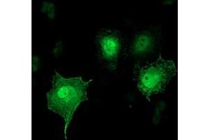 Anti-SH2D2A mouse monoclonal antibody (ABIN2455606) immunofluorescent staining of COS7 cells transiently transfected by pCMV6-ENTRY SH2D2A (RC204162). (SH2D2A Antikörper)