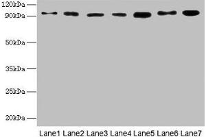Western blot All lanes: USP5 antibody at 10 μg/mL Lane 1: Mouse brain tissue Lane 2: A549 whole cell lysate Lane 3: MCF-7 whole cell lysate Lane 4: A375 whole cell lysate Lane 5: U251 whole cell lysate Secondary Goat polyclonal to rabbit IgG at 1/10000 dilution Predicted band size: 96, 94 kDa Observed band size: 96 kDa
