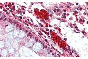Detection of HEXb in Human Colon Tissue using Polyclonal Antibody to Hexosaminidase B Beta (HEXb)