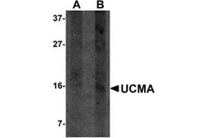 Western Blotting (WB) image for anti-Upper Zone of Growth Plate and Cartilage Matrix Associated (UCMA) (C-Term) antibody (ABIN1030790) (UCMA Antikörper  (C-Term))