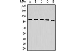 Western blot analysis of USP10 expression in HepG2 (A), A549 (B), mouse liver (C), mouse kidney (D), rat brain (E) whole cell lysates. (USP10 Antikörper)