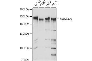 Western blot analysis of extracts of Mouse lung, using KI antibody (ABIN7269712) at 1:2080 dilution. (Protein Virilizer Homolog (VIRMA) (AA 1400-1700) Antikörper)