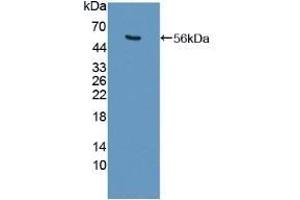 Detection of Recombinant USP7, Human using Polyclonal Antibody to Ubiquitin Specific Peptidase 7 (USP7) (USP7 Antikörper  (AA 54-507))