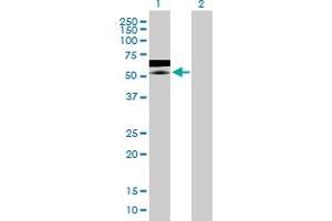 Western Blot analysis of ZNF358 expression in transfected 293T cell line by ZNF358 MaxPab polyclonal antibody. (ZNF358 Antikörper  (AA 1-481))