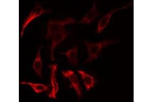 ABIN6275177 staining COLO205  cells by IF/ICC. (GNAT1 Antikörper  (Internal Region))