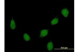 Immunofluorescence of purified MaxPab rabbit antibody to HOXB7 on HeLa cell. (HOXB7 Antikörper  (AA 1-217))