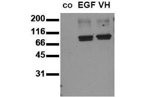 Western Blotting (WB) image for anti-Signal Transducer and Activator of Transcription 3 (Acute-Phase Response Factor) (STAT3) (pTyr705) antibody (ABIN126898) (STAT3 Antikörper  (pTyr705))