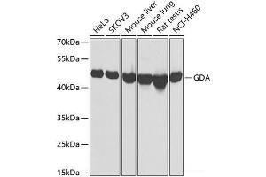 Western blot analysis of extracts of various cell lines using GDA Polyclonal Antibody at dilution of 1:1000. (GDA Antikörper)