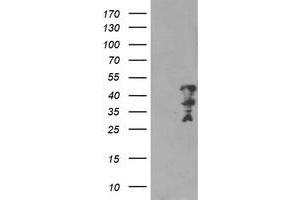 Western Blotting (WB) image for anti-Myeloid Leukemia Factor 2 (MLF2) antibody (ABIN1499501) (MLF2 Antikörper)