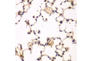 Immunohistochemistry of paraffin-embedded rat lung using NFKBIB antibody (ABIN6130475, ABIN6144584, ABIN6144585 and ABIN6221459) at dilution of 1:200 (40x lens). (NFKBIB Antikörper  (AA 1-356))
