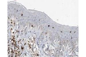 Immunohistochemical staining of human skin with INSL5 polyclonal antibody  shows distinct positivity in Langerhans cells.