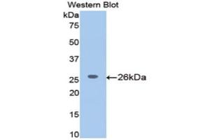 Western Blotting (WB) image for anti-Meningioma Expressed Antigen 5 (Hyaluronidase) (MGEA5) (AA 19-222) antibody (ABIN1172151) (MGEA5 Antikörper  (AA 19-222))