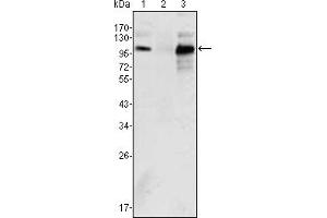 Western blot analysis using Androgen receptor mouse mAb against K562 (1), Jurkat (2) and LNCaP (3) cell lysate. (Androgen Receptor Antikörper)