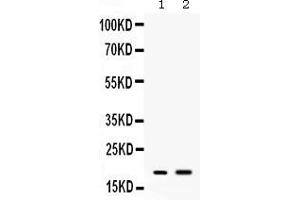 Western blot analysis of Peptide YY expression in mouse spleen extract ( Lane 1) and mouse liver extract ( Lane 2). (Peptide YY Antikörper  (Middle Region))