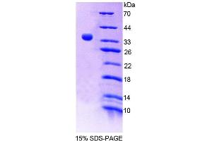 SDS-PAGE analysis of Mouse BPNT1 Protein.
