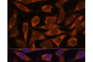Immunofluorescence analysis of L929 cells using ME3 Polyclonal Antibody at dilution of 1:100.