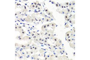 Immunohistochemistry of paraffin-embedded human stomach using CBX1 antibody (ABIN5971253) at dilution of 1/100 (40x lens). (CBX1 Antikörper)