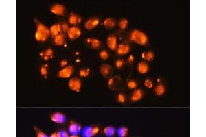 Immunofluorescence analysis of HeLa cells using EPB41L2 Polyclonal Antibody at dilution of 1:100. (EPB41L2 Antikörper)