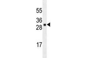 UBTD1 antibody western blot analysis in A549 lysate. (UBTD1 Antikörper)