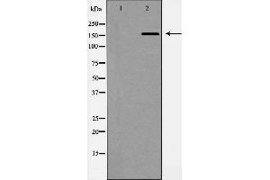 Western blot analysis of extracts of A549 lysate, using ABCC1antibody. (ABCC1 Antikörper  (N-Term))