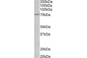 ABIN870688 (1µg/ml) staining of Rat Heart lysate (35µg protein in RIPA buffer). (NGFR Antikörper  (AA 202-215))