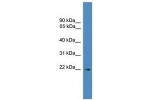 Image no. 1 for anti-Synovial Sarcoma, X Breakpoint 3 (SSX3) (C-Term) antibody (ABIN6745264) (SSX3 Antikörper  (C-Term))