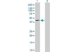 Western Blot analysis of FASN expression in transfected 293T cell line by FASN monoclonal antibody (M01A), clone 3F2-1F3. (Fatty Acid Synthase Antikörper  (AA 1-439))