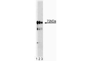 Western blot analysis of LIMK1 on rat cerebellum lysate. (LIM Domain Kinase 1 Antikörper  (AA 232-333))
