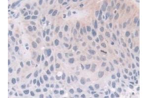Immunohistochemistry (IHC) image for anti-FK506 Binding Protein 4, 59kDa (FKBP4) (AA 2-459) antibody (ABIN7441208)