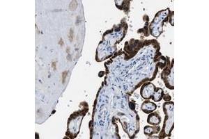 Immunohistochemical staining of human placenta with BPGM polyclonal antibody  shows strong cytoplasmic positivity in trophoblastic cells at 1:50-1:200 dilution. (BPGM Antikörper)