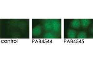 Indirect immunofluorescence analysis of GFP-PRKD3 fusion protein expression in Panc-1 cells by using PRKD3 polyclonal antibody  and PRKD3 polyclonal antibody  .
