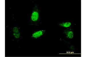 Immunofluorescence of monoclonal antibody to SURB7 on HepG2 cell.