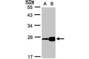 WB Image Sample(30 ug whole cell lysate) A:HeLa S3, B:Hep G2 , 12% SDS PAGE antibody diluted at 1:1000 (FABP6 Antikörper)