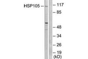 Western blot analysis of extracts from HeLa cells, using HSP105 Antibody. (HSPH1 Antikörper  (AA 791-840))