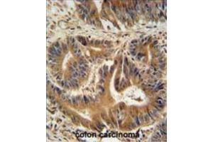 Immunohistochemistry (Paraffin-embedded Sections) (IHC (p)) image for anti-Vacuolar Protein Sorting 52 Homolog (VPS52) (AA 613-641), (C-Term) antibody (ABIN955527)
