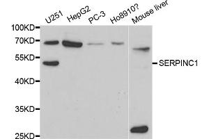 Western blot analysis of extracts of various cell lines, using SERPINC1 antibody. (SERPINC1 Antikörper)