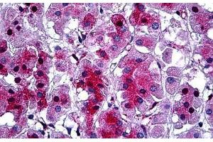 Human Adrenal: Formalin-Fixed, Paraffin-Embedded (FFPE)