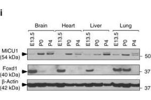 MICU1 is transcriptionally regulated by Foxd1 under hypoxia. (FOXD1 Antikörper  (C-Term))